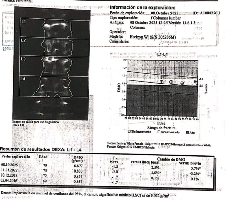 Densitometria osea posterior al tratamiento en paciente con osteopenia.