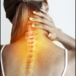 Ilustración de un esguince cervical